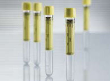 Vacuette® Urinalysis Tube, 9 mL
