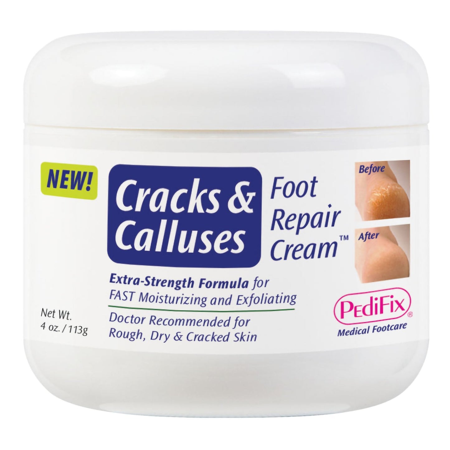 PediFix® Cracks and Calluses Foot Repair Cream™, Jar