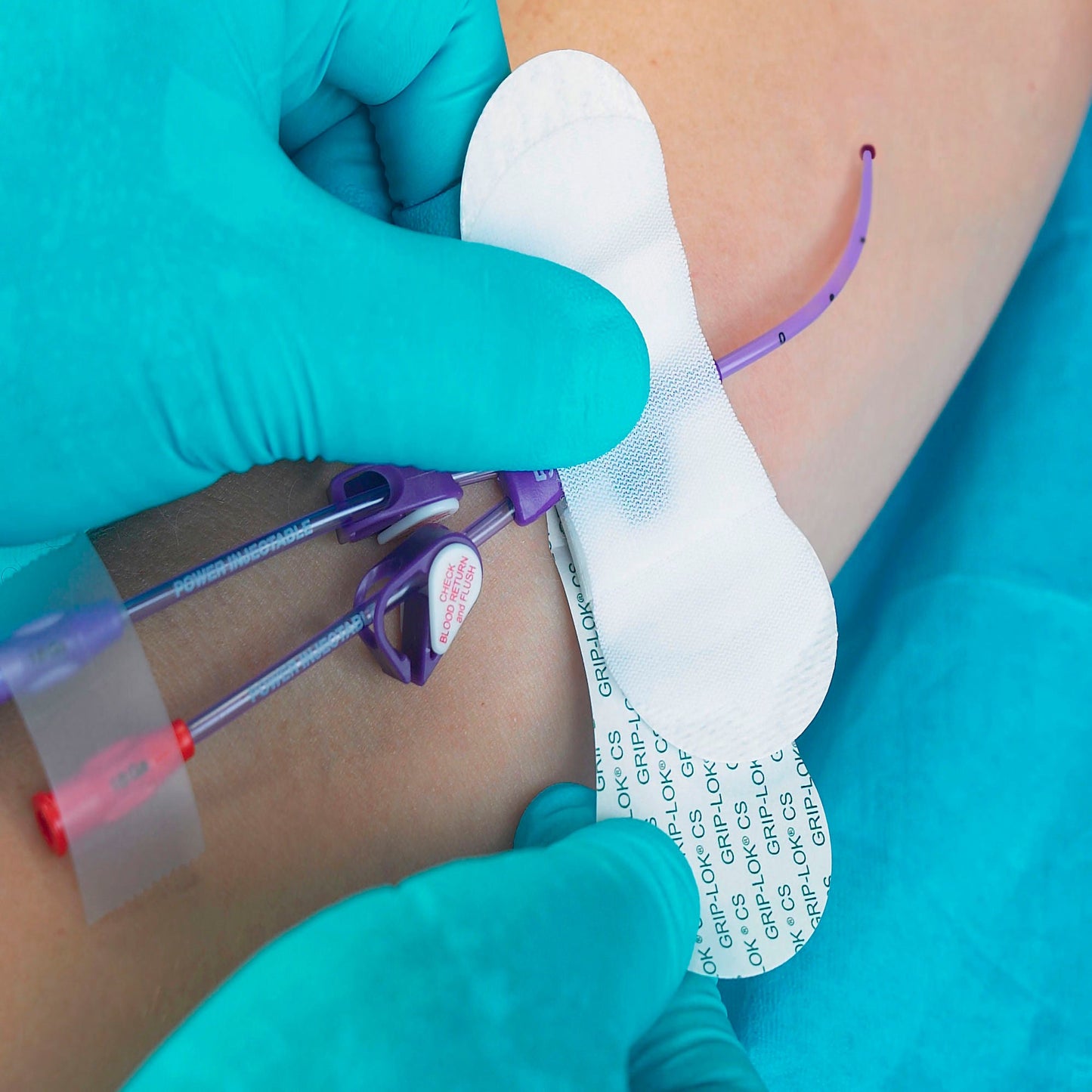 Grip-Lok Catheter / Line Securement Device Fits Bard Hub