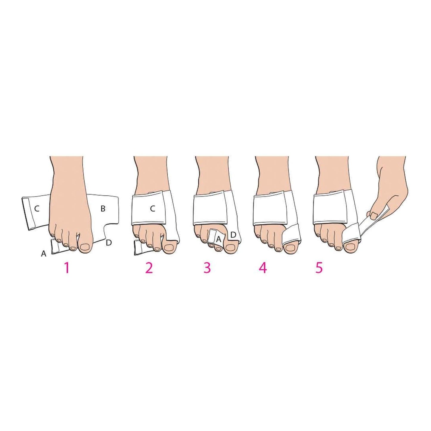 Softsplint™ Bunion Splint for Left Foot