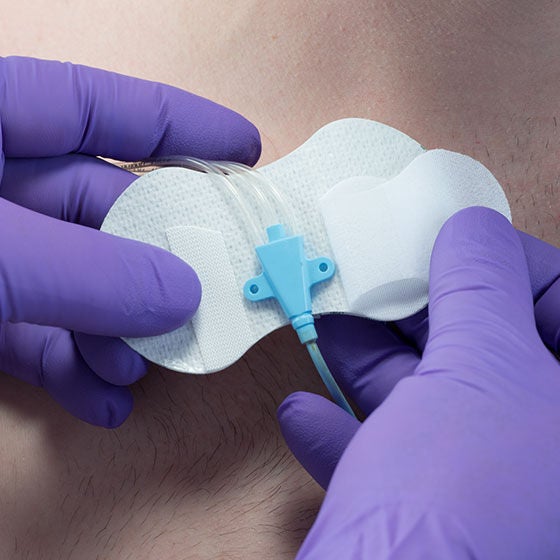 Grip-Lok Catheter / Line Securement Device For CVC and PICC Securement