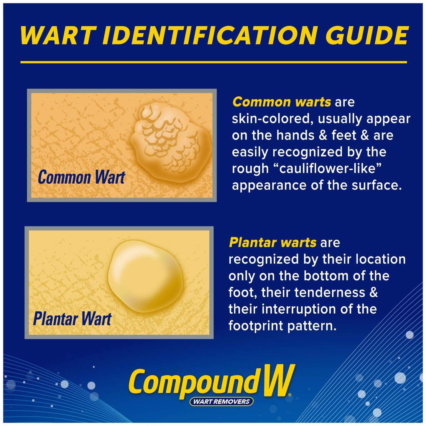 Compound W® Freeze Off® Dimethyl Ether / Propane Wart Remover
