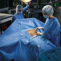 Abdominal Drape Laparoscopic / Abdominal Drape 100 W X 76 W X Inch