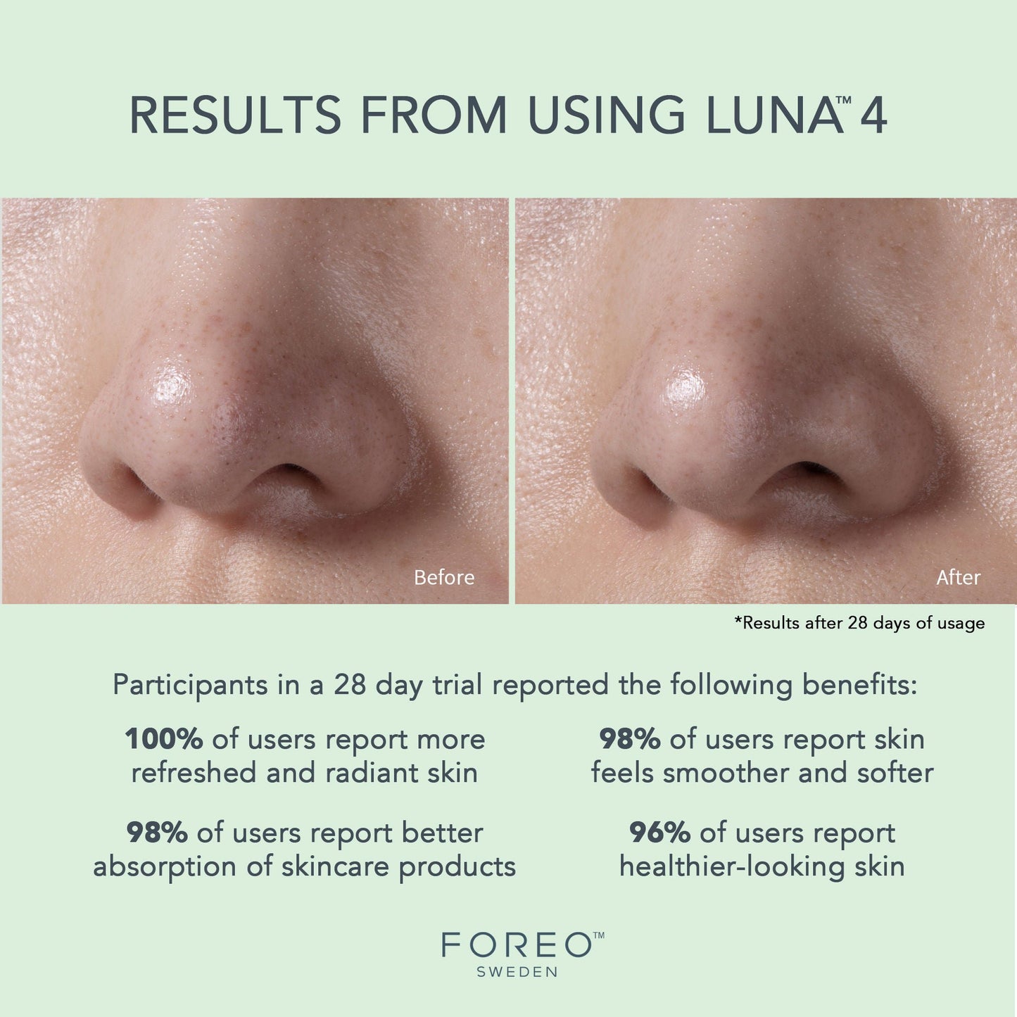 LUNA™ 4 Facial Cleansing Device for Combination Skin