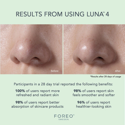 LUNA™ 4 Facial Cleansing Device for Combination Skin