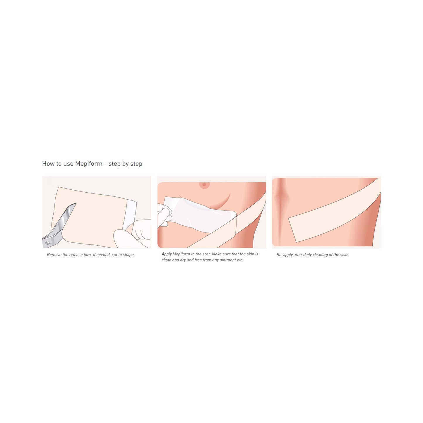 Mepiform® Self Adherent Silicone Dressing