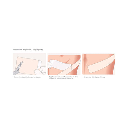 Mepiform® Self Adherent Silicone Dressing