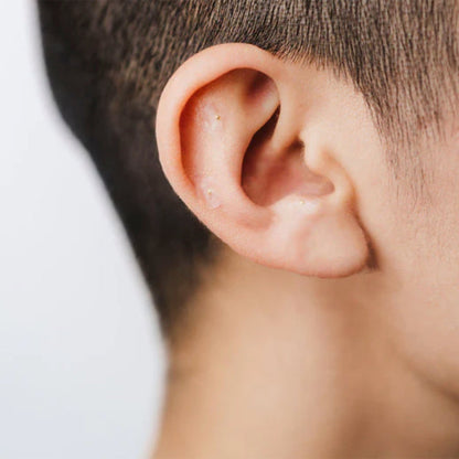 Kanjo Acupressure Ear Seeds