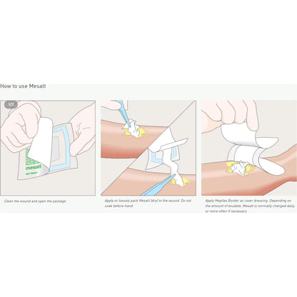 Mesalt® Sodium Chloride Impregnated Dressing