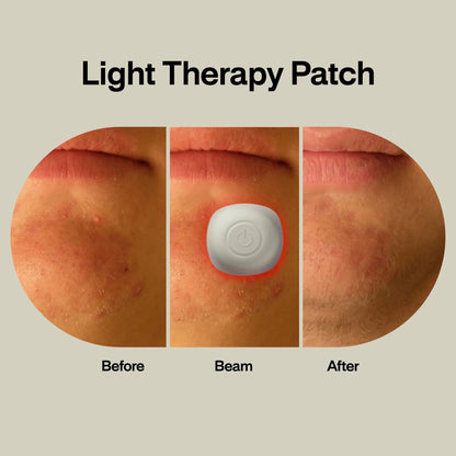 LAB Acne Light Therapy Patch Acne Treatments with Lightpod and Four Hydrogrips