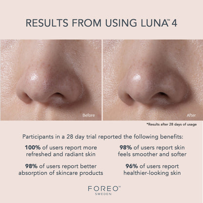LUNA™ 4 Facial Cleansing Device for Balanced Skin