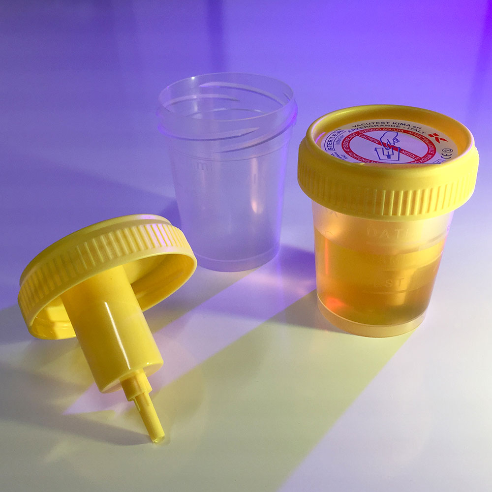 Urine Collection Cups with Integrated Transfer Device, 60 mL, Sterile — Individually Wrapped, 100/Case | Globe Scientific
