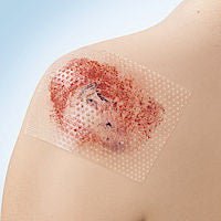 Cuticell Contact Wound Contact Layer Dressing