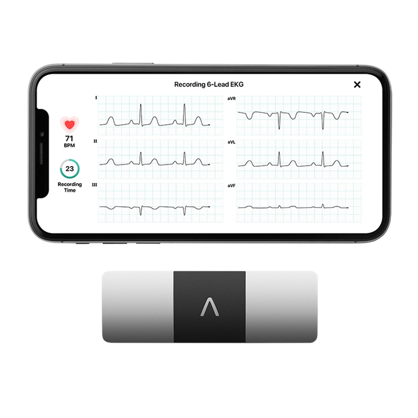KardiaMobile® Electrocardiograph