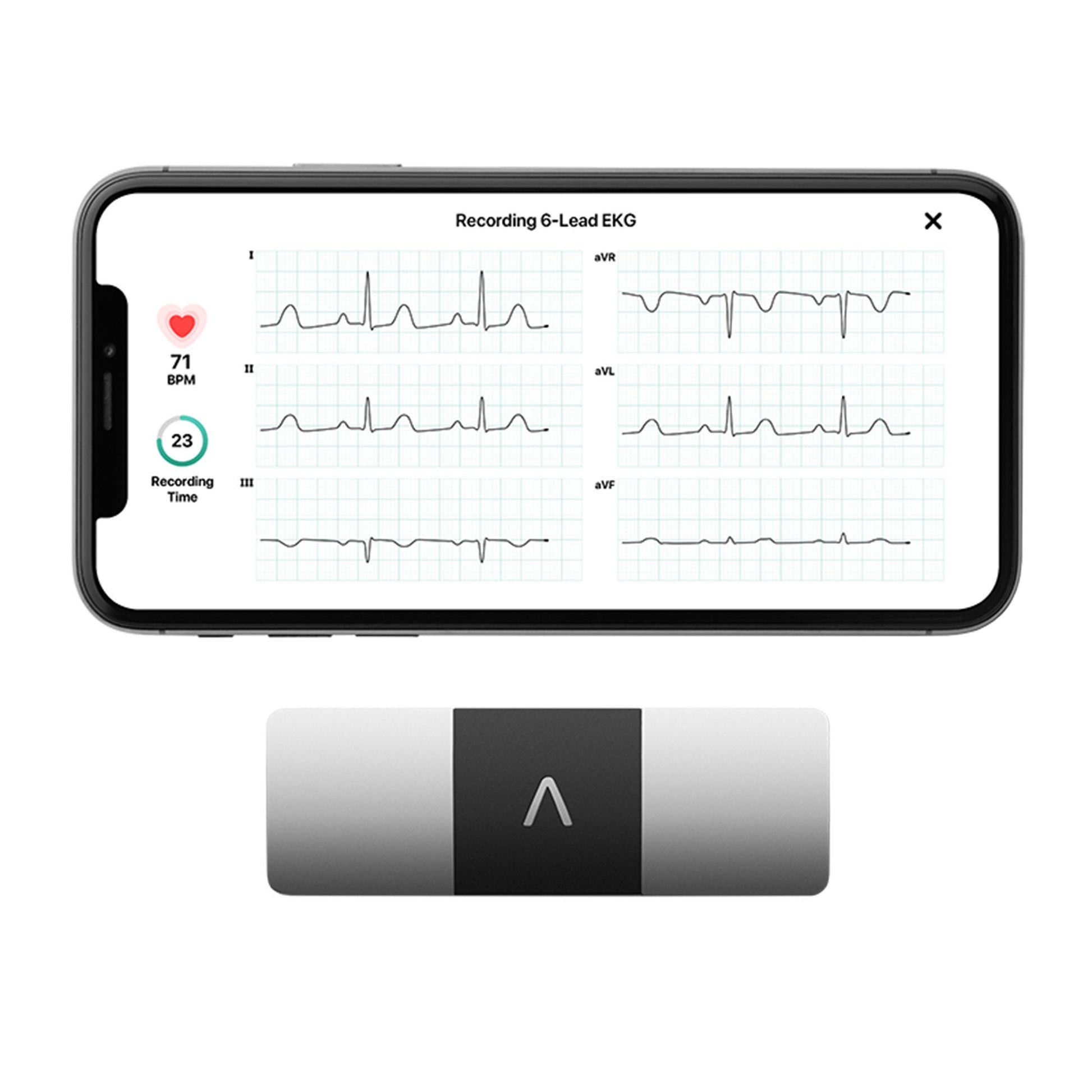 KardiaMobile® Electrocardiograph