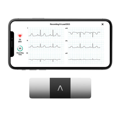 KardiaMobile® Electrocardiograph