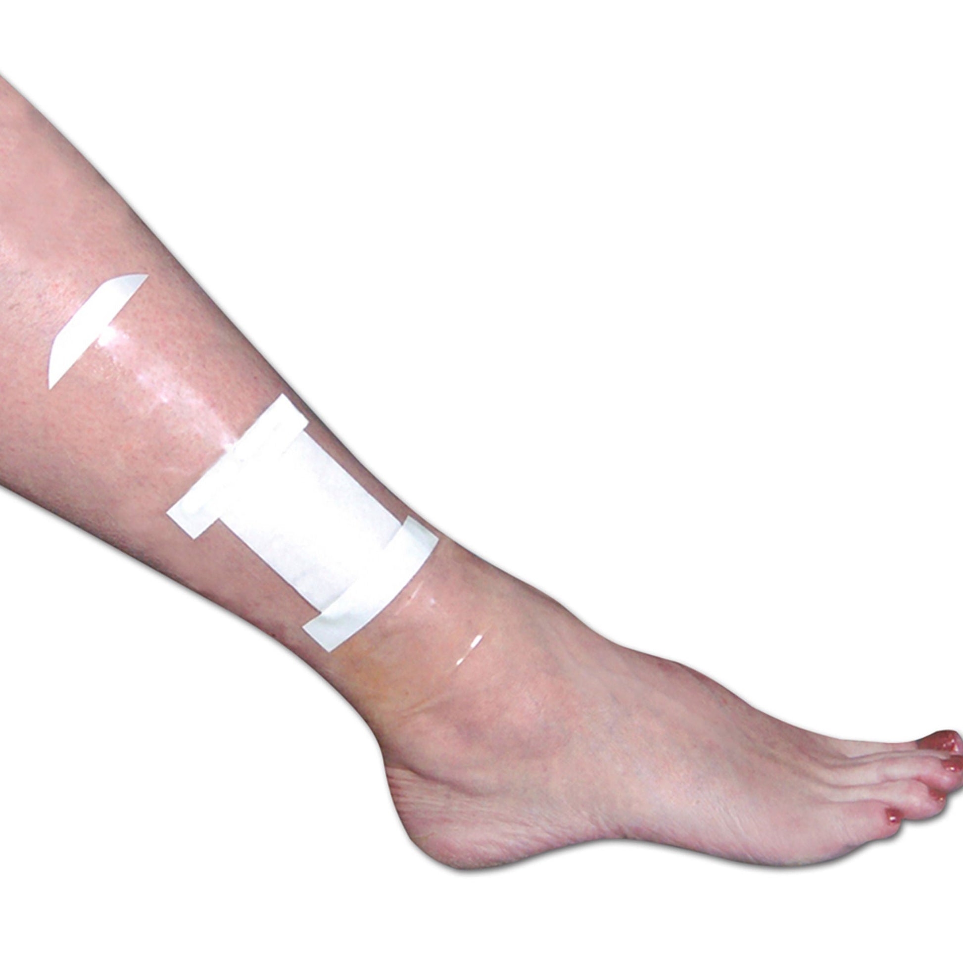 Seal-Tight® Shield Dressing