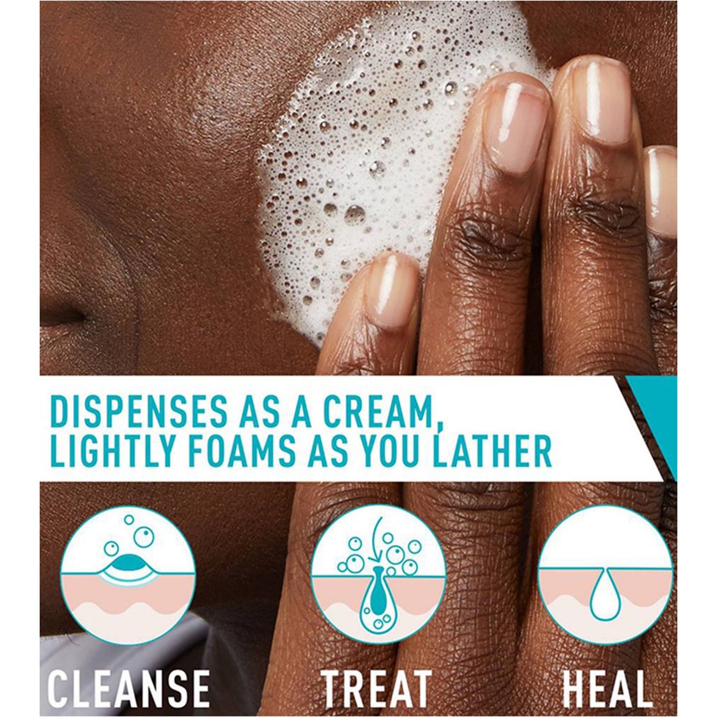 CeraVe® Acne Foaming Cream Cleanser