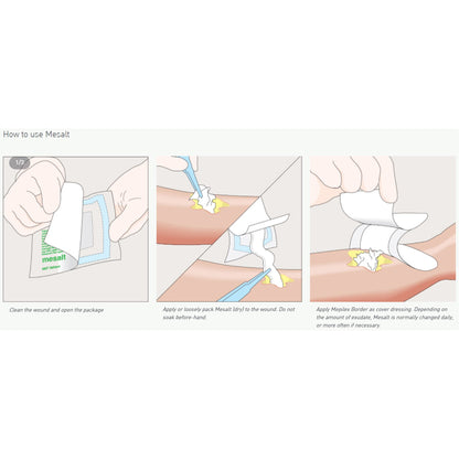 Mesalt® Sodium Chloride Impregnated Dressing, ¾ x