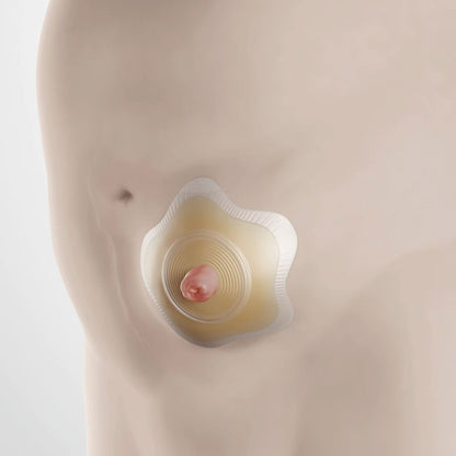 SenSura® Mio Convex Flip Ostomy Barrier, Stoma Opening, Red Match