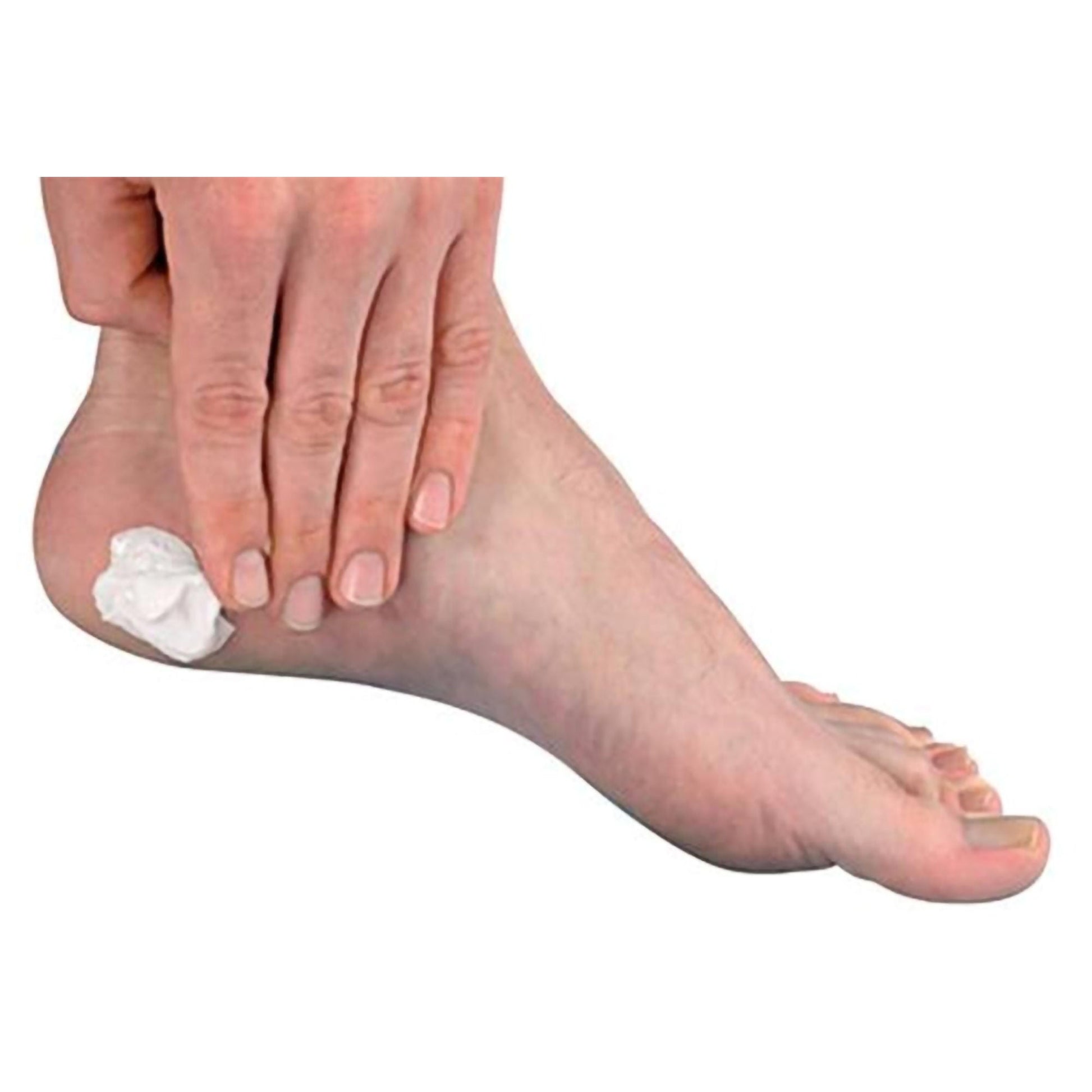Podiatrists' Choice® Callus Control Cream Foot Moisturizer, Jar