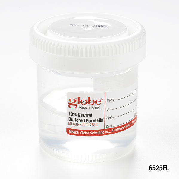 Prefilled Formalin Specimen Containers, PP Click-Close Lid (Tite-Rite) — 20–120 mL, 10% NBF, Case | Globe Scientific