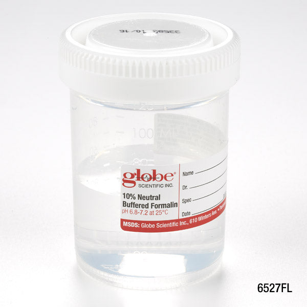 Prefilled Formalin Specimen Containers, PP Click-Close Lid (Tite-Rite) — 20–120 mL, 10% NBF, Case | Globe Scientific