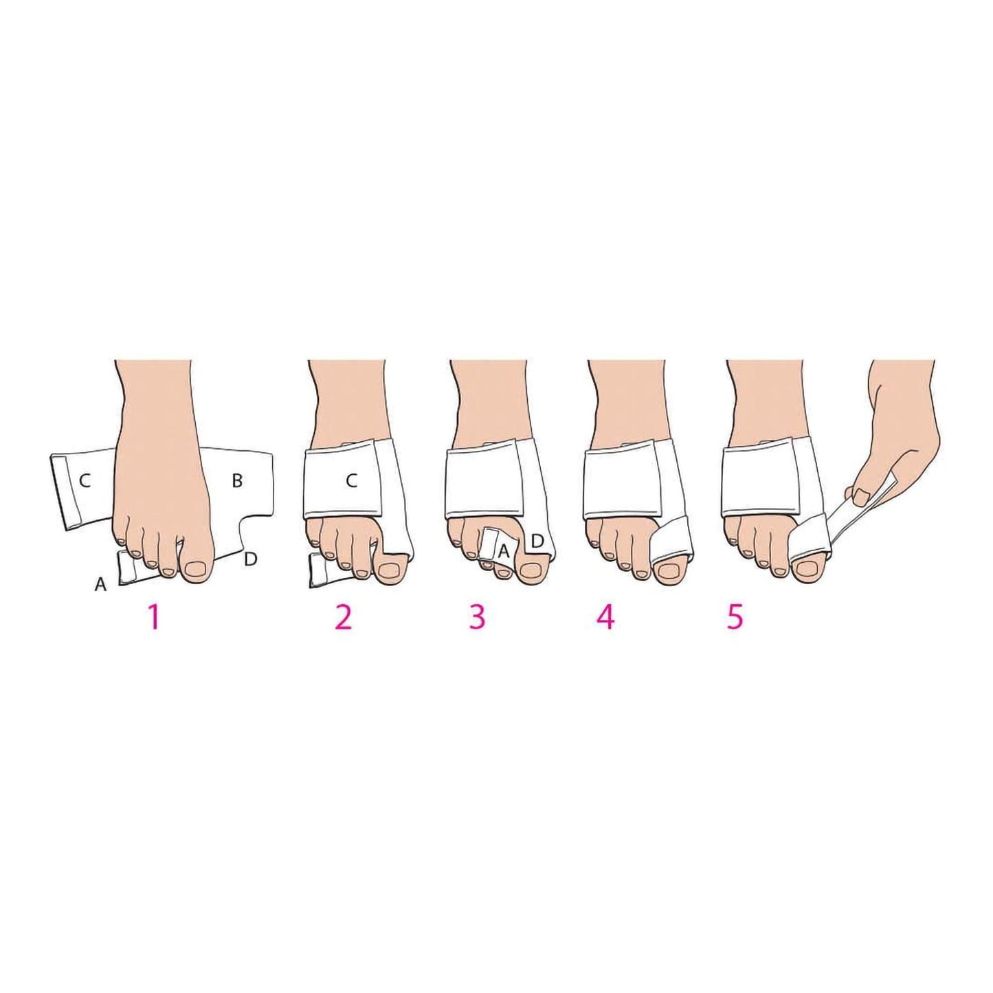Softsplint™ Bunion Splint for Left Foot