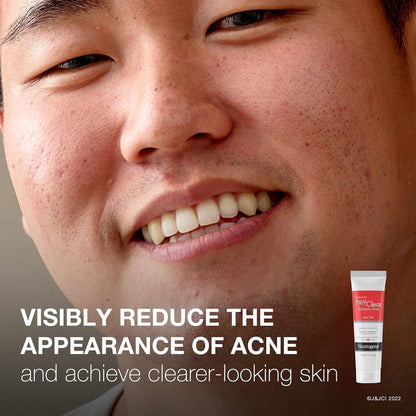Neutrogena® Rapid Clear Stubborn Acne Spot 10% Benzoyl Peroxide Gel