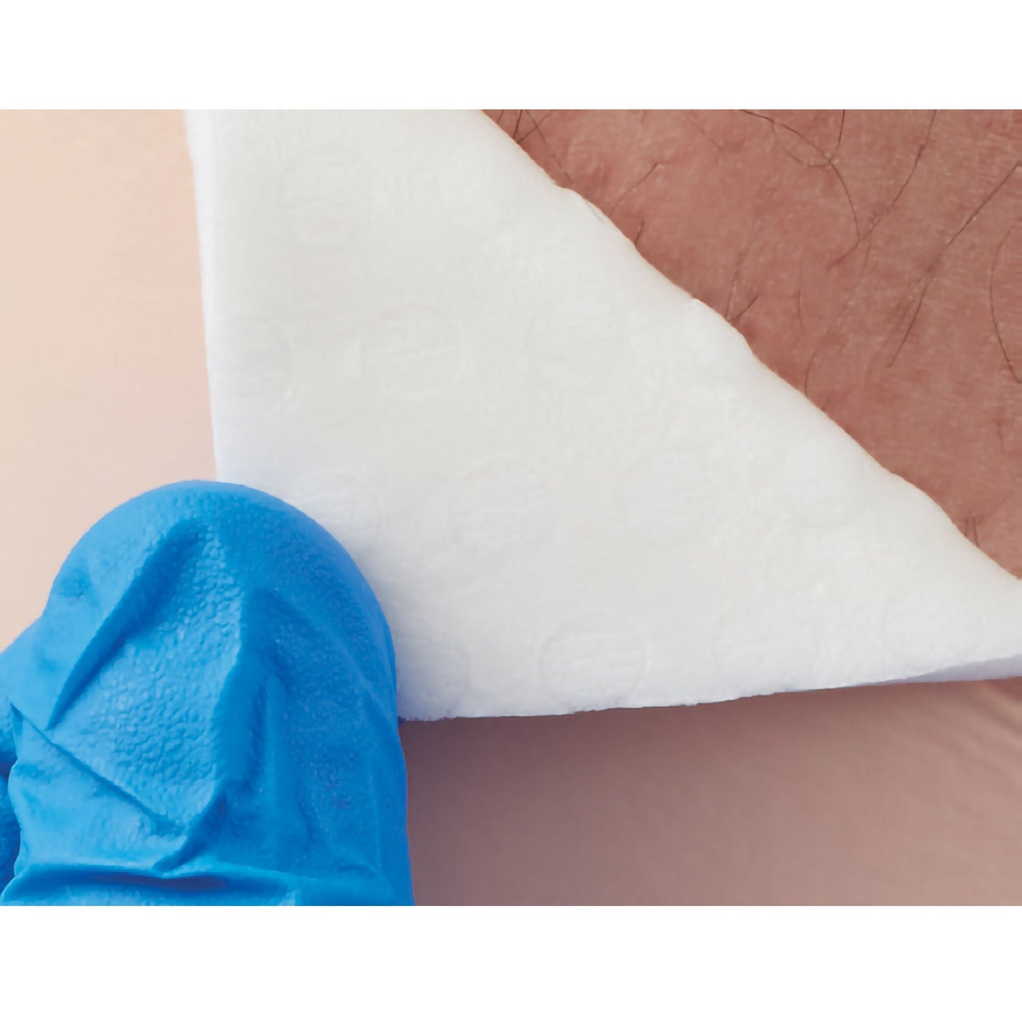 Advazorb Silfix® Nonadhesive without Border Silicone Foam Dressing