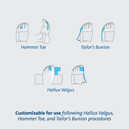 TAS™ Toe Splint