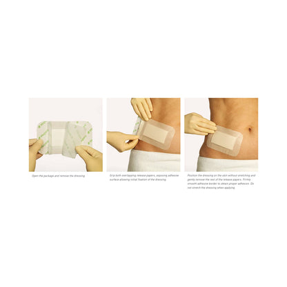 Mepore® Pro White Adhesive Dressing
