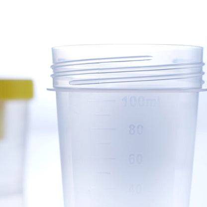 Urine Specimen Container with Integrated Transfer Device (3.4 oz.) Screw Cap Patient Information