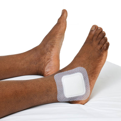 Biatain Silicone Fit Silicone Foam Dressing With Border Film Backing Silicone Adhesive Sacral