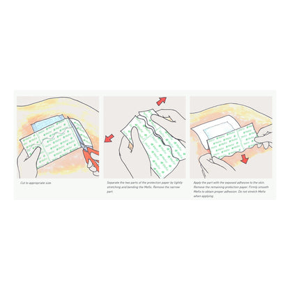 Mefix® Nonwoven Dressing Retention Tape, White