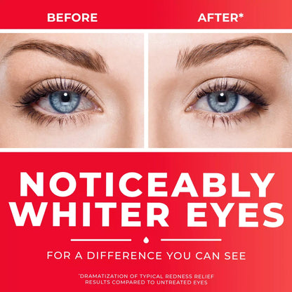 Clear Eyes® Redness Relief Eye Drops