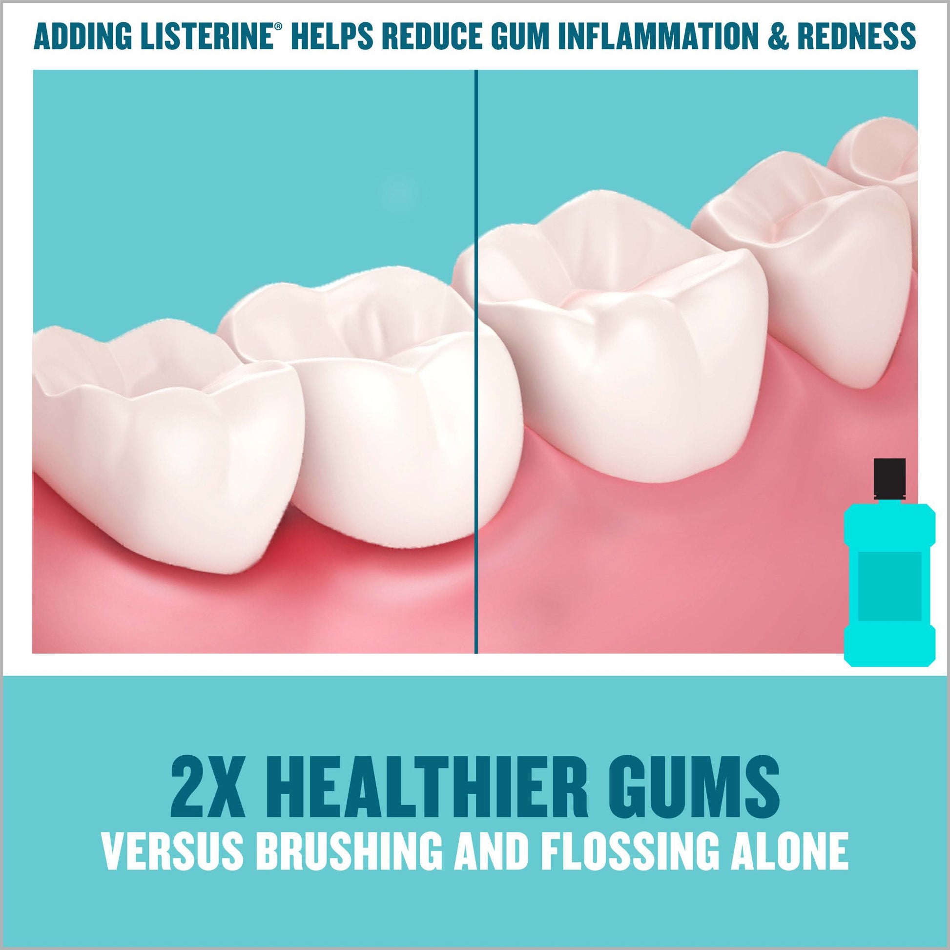 Listerine® Cool Mint Antiseptic Mouthwash