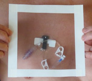 HydroSeal Sleeve Arm Cast Protector Plastic