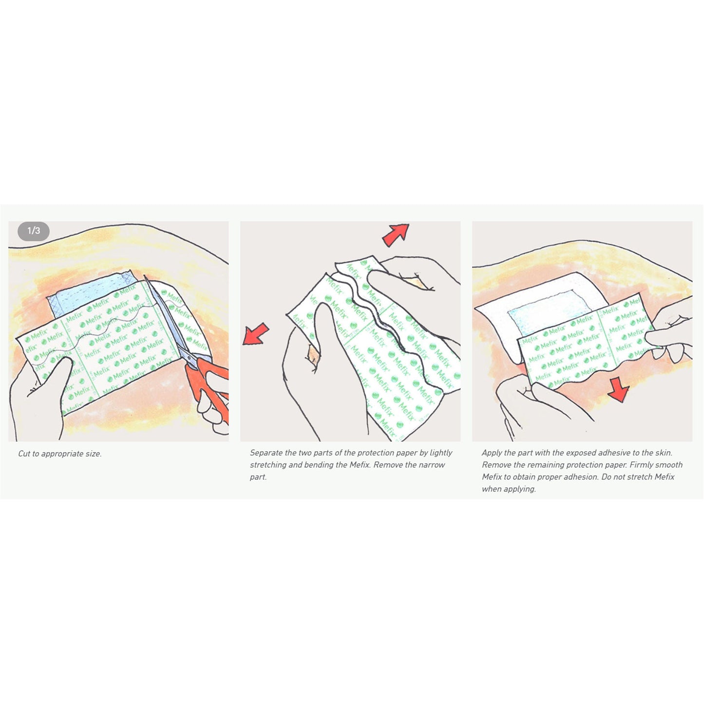 Mefix® Nonwoven Dressing Retention Tape