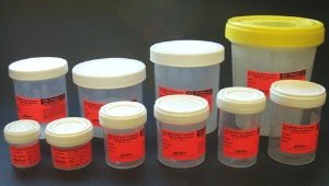 SP® Prefilled Formalin Container, Fill in 60 mL
