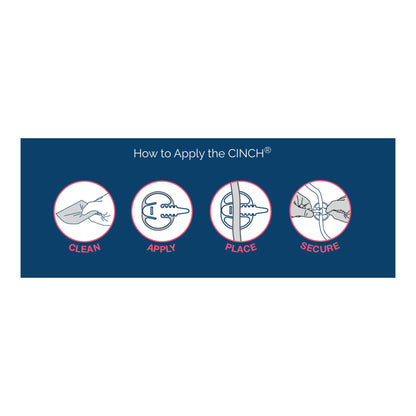 Cinch® Tube Securement Device, Large