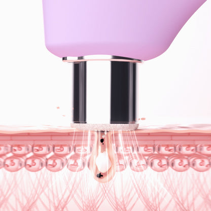 KIWI™ derma Microdermabrasion Pore Vacuum